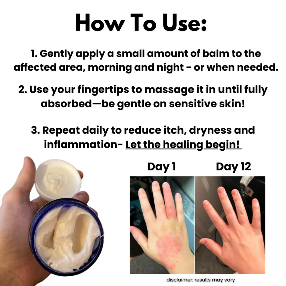 Natural Eczema Balm